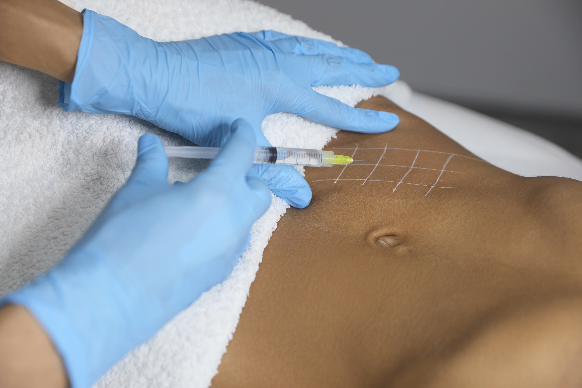 Young Woman Getting Belly Injection in Salon, Closeup